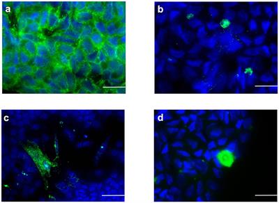 “In vitro” Effect of Different Follicle—Stimulating Hormone Preparations on Sertoli Cells: Toward a Personalized Treatment for Male Infertility